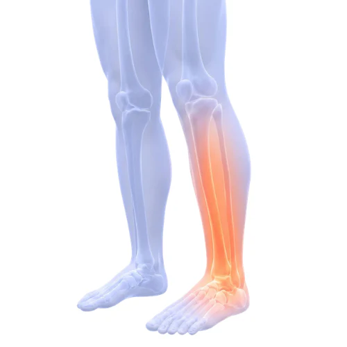 E-BOOK - Le guide Soveria : Jambes légères en 7 jours